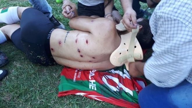 Video - Polis futbolculara plastik mermi sıktı