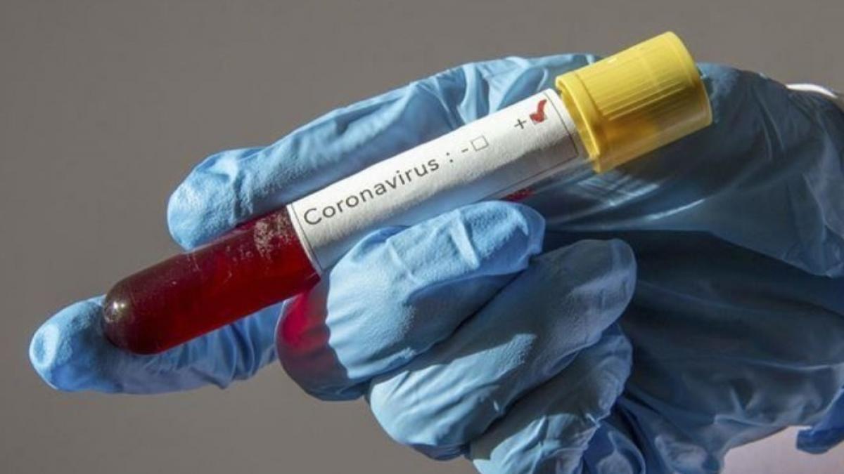 turkiye de koronavirus covid 19 testi ucretsiz mi istanbul da hangi hastanede yapilir ajansspor com